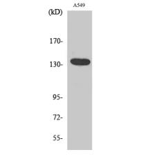 Anti-DREG antibody