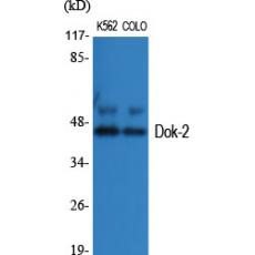 Anti-Dok-2 antibody
