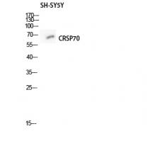 Anti-CRSP70 antibody