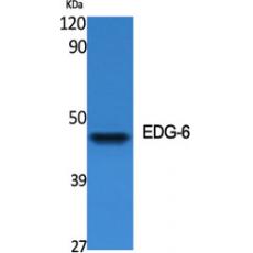 Anti-EDG-6 antibody