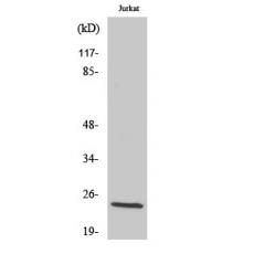 Anti-dTMP Kinase antibody