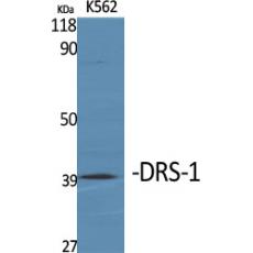 Anti-DRS-1 antibody
