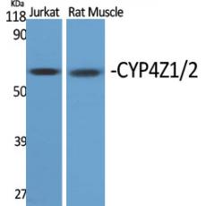Anti-CYP4Z1/2 antibody