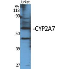 Anti-CYP2A7 antibody