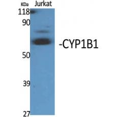 Anti-CYP1B1 antibody