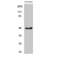 Anti-CYP11B1/2 antibody