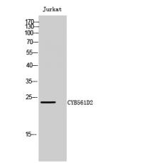 Anti-CYB561D2 antibody