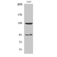 Anti-GABAB R1 antibody