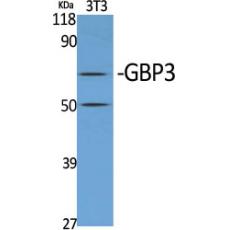 Anti-GBP3 antibody