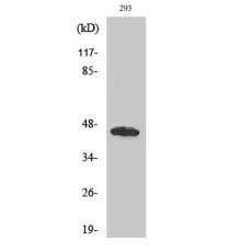 Anti-GBDR1 antibody