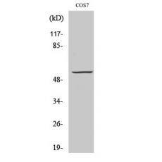 Anti-GPR101 antibody