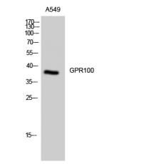 Anti-GPR100 antibody