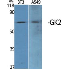 Anti-GK2 antibody