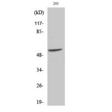 Anti-Fgl2 antibody