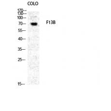 Anti-Factor XIII B antibody