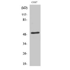 Anti-ETAR antibody