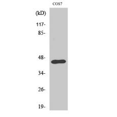 Anti-Ephrin-B1 antibody