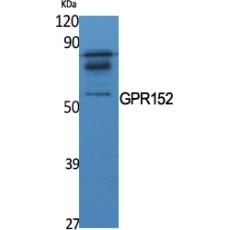 Anti-GPR152 antibody
