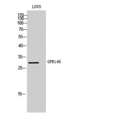 Anti-GPR146 antibody