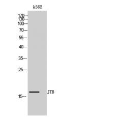 Anti-JTB antibody