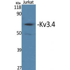 Anti-Kv3.4 antibody