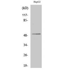 Anti-Lad antibody