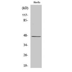 Anti-LASS4 antibody