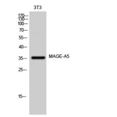 Anti-MAGE-A5 antibody