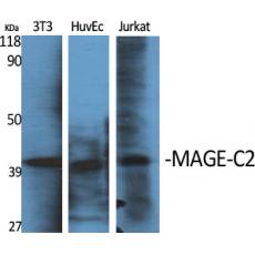 Anti-MAGE-C2 antibody