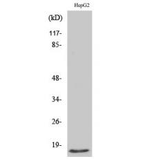 Anti-Mammaglobin B antibody