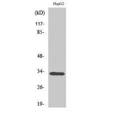 Anti-DcR3 antibody