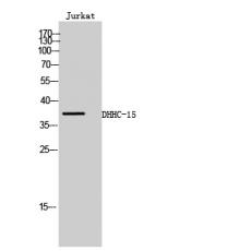 Anti-DHHC-15 antibody