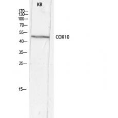 Anti-COX10 antibody