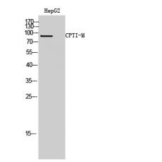 Anti-CPTI-M antibody