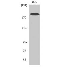 Anti-COL5A1 antibody