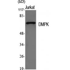 Anti-DMPK antibody