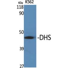 Anti-DHS antibody