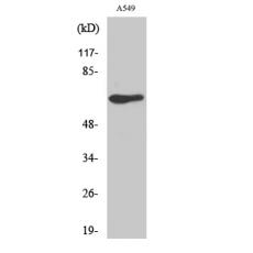 Anti-GPR50 antibody