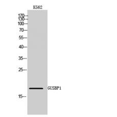 Anti-GUSBP1 antibody