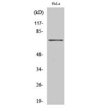 Anti-HKR1 antibody