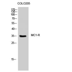 Anti-MC1-R antibody