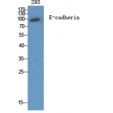 Anti-E-cadherin antibody