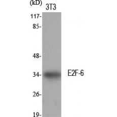 Anti-E2F-6 antibody