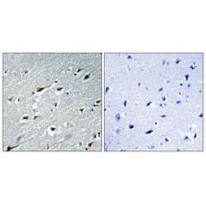 Anti-HAND1 antibody