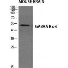 Anti-GABAA Rα6 antibody
