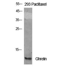 Anti-Ghrelin antibody