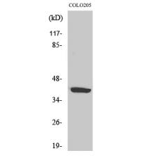 Anti-GPR105 antibody