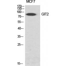 Anti-GIT2 antibody