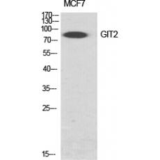 Anti-GIT2 antibody