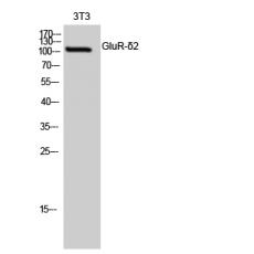 Anti-GluR-δ2 antibody